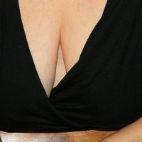 Breast Perspective