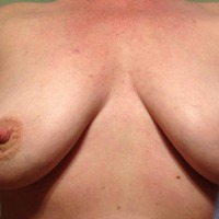 My medium tits - Gumdrops