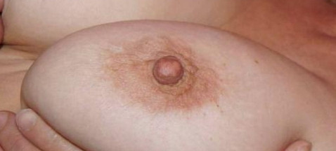 Pic #1 Nippel